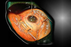 Afyon'da göz muayene skandalı