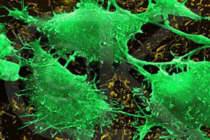 KANSER HASTALIĞINDA DEVRİM