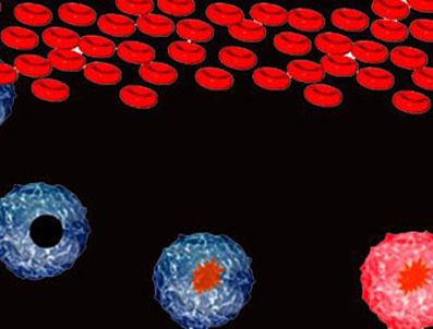 Kanseri hapla durdurdu