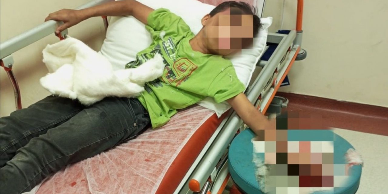 Parmağını sıkıştıranların imdadına itfaiye yetişti