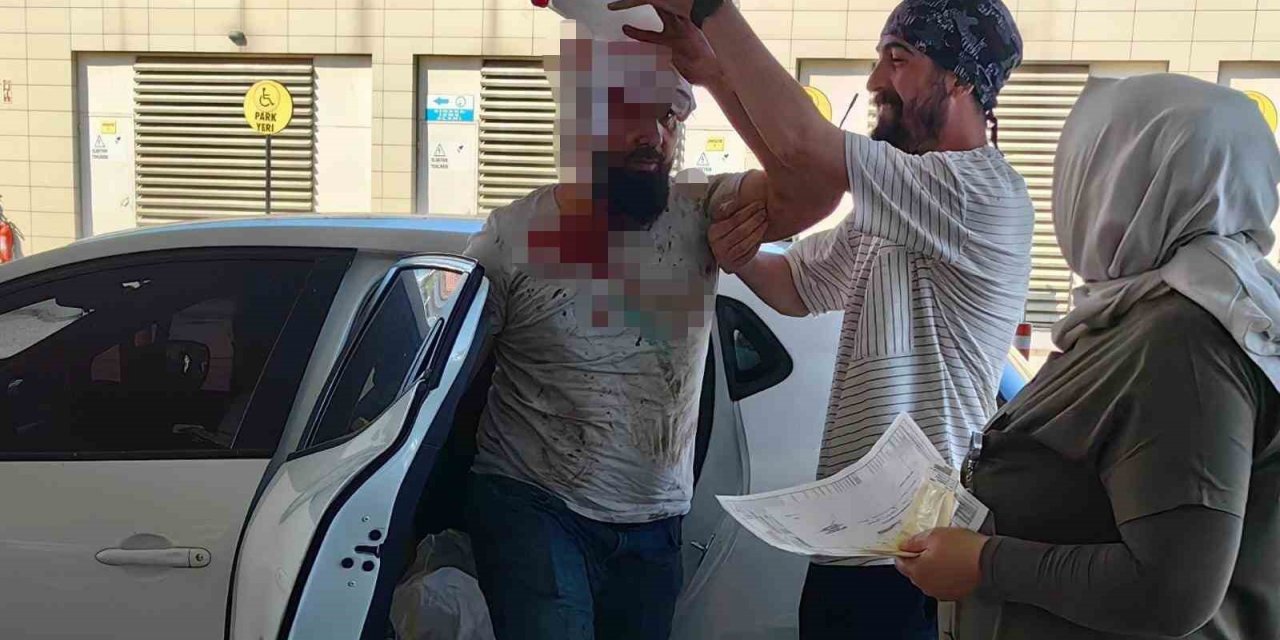 Bursa’da kendini kesen acemi kasap sayısı 462 oldu