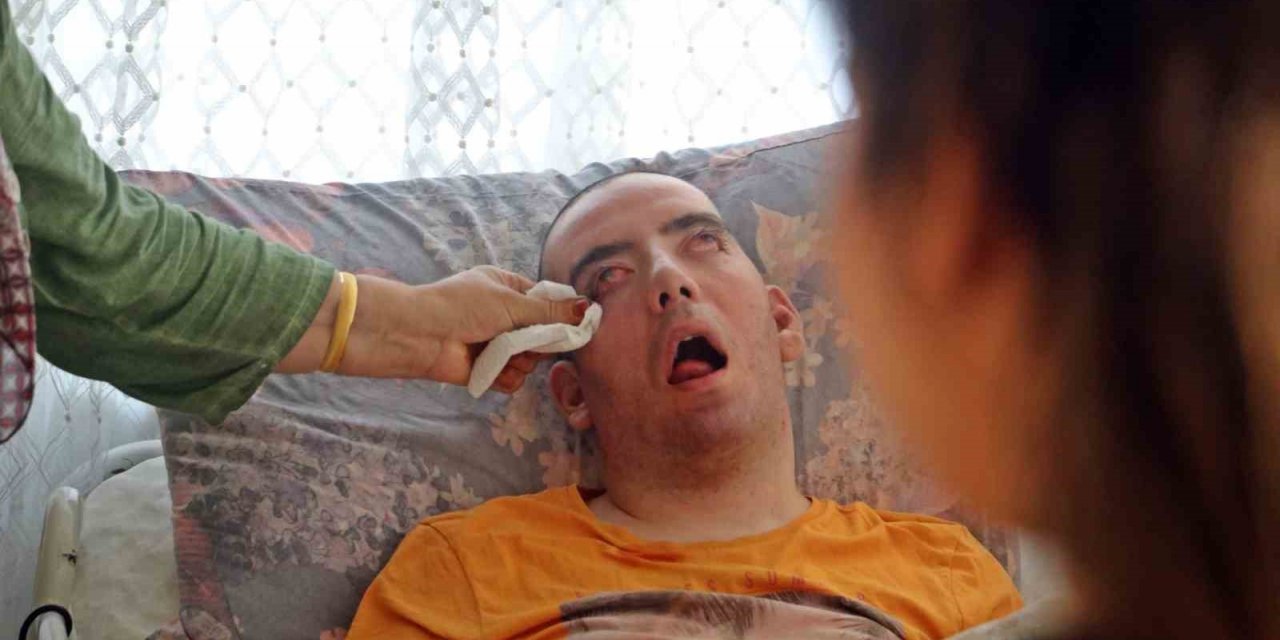 Doktorlar 6 ay ömür biçti, 10 yıldır gözlerini bir an olsun kırpmadan yaşam savaşı veriyor