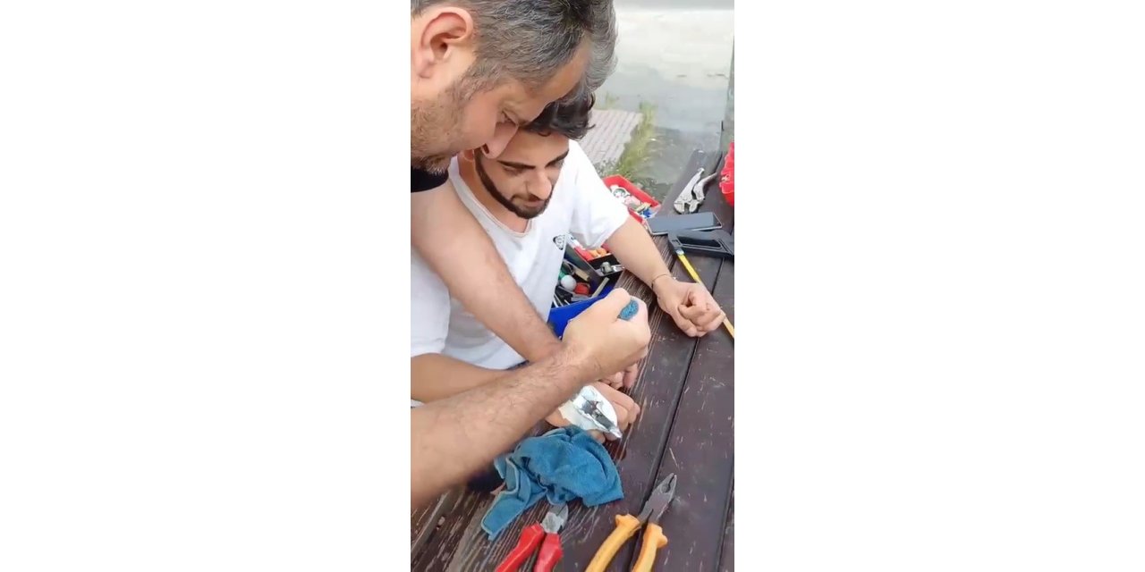 Parmağına sıkışan yüzük spiral makinesi ile kesilerek çıkarıldı