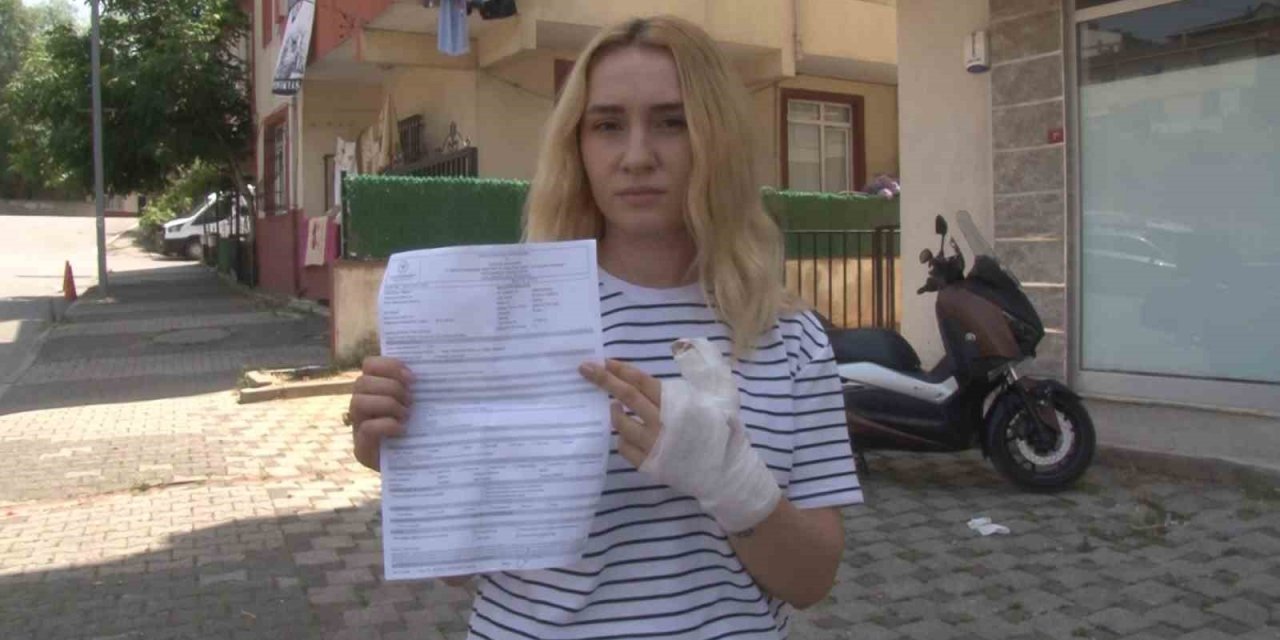 Sultanbeyli’de X-Ray krizi: İş arkadaşının parmağını ısırdı