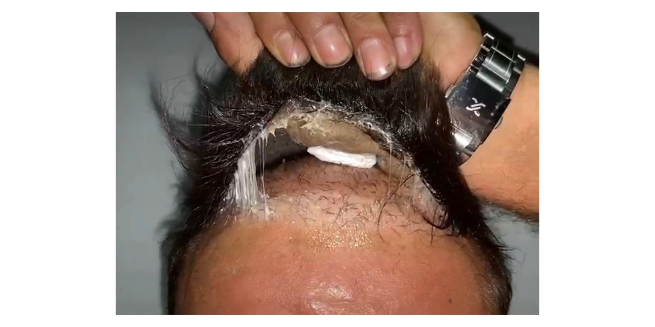 Şüphelinin peruğundan uyuşturucu çıktı