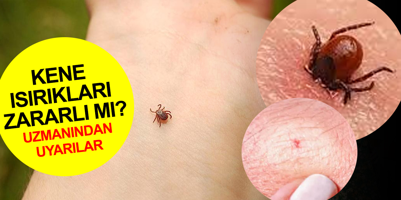 Kene ısırıkları zararlı mı? Konya Büyükşehir Hastanesi Doktoru Önat'tan önemli uyarılar