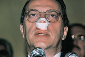 Mesut Yılmaz'a atılan yumruğun sırrı