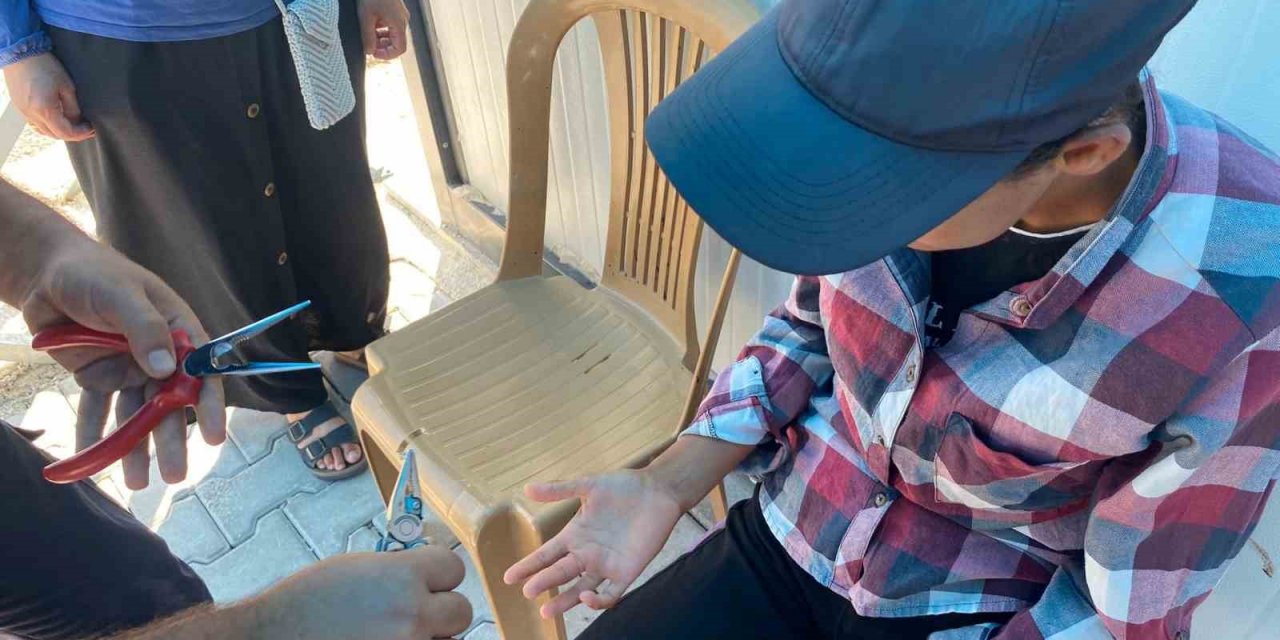 Yüzüğü çıkaramayınca yardımına itfaiye yetişti