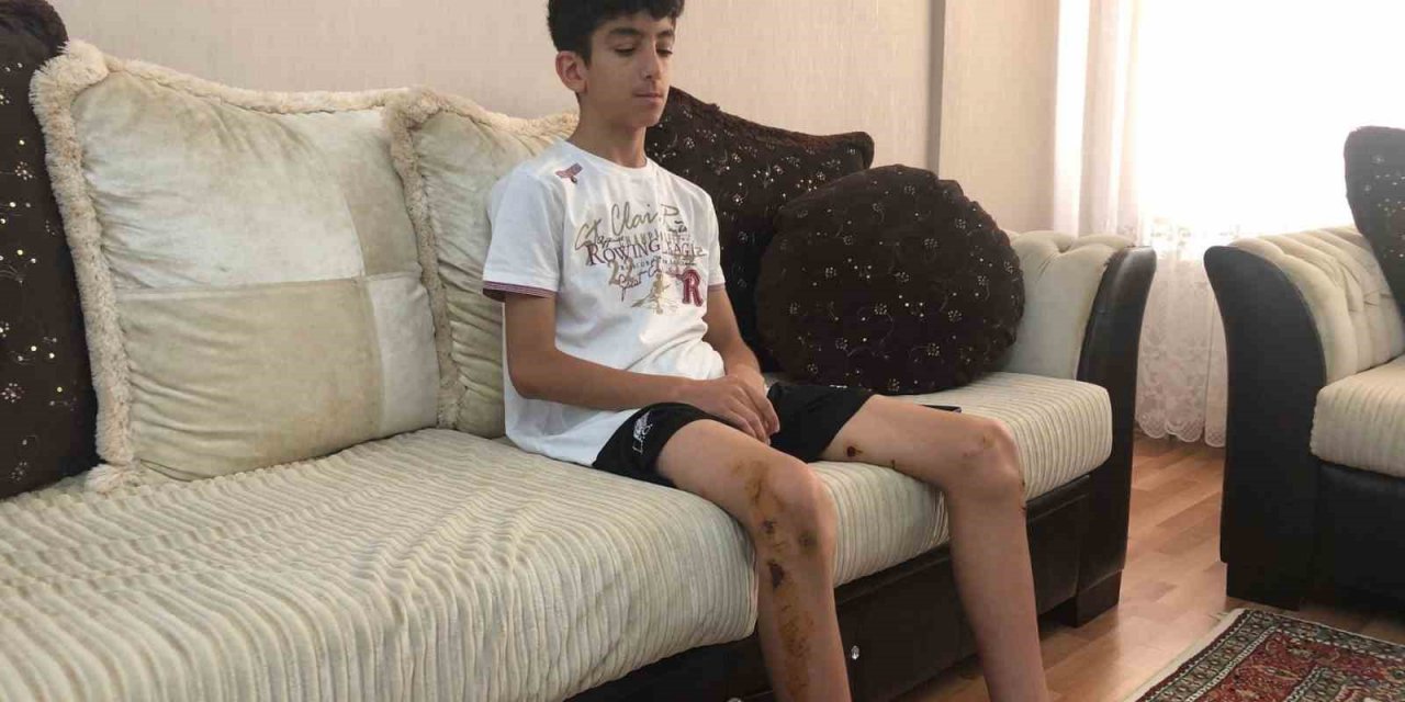 Köpeklerin saldırdığı 13 yaşındaki çocuk ölümden döndü