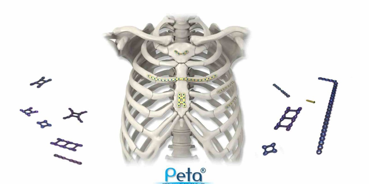 INVAMED’den göğüs kemiği kapatma plakası