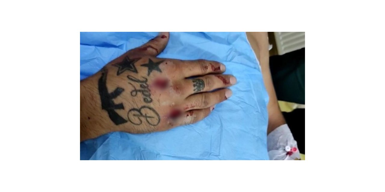 Patnos’ta ehliyetsiz motosiklet sürücüsü polis aracına çarptı