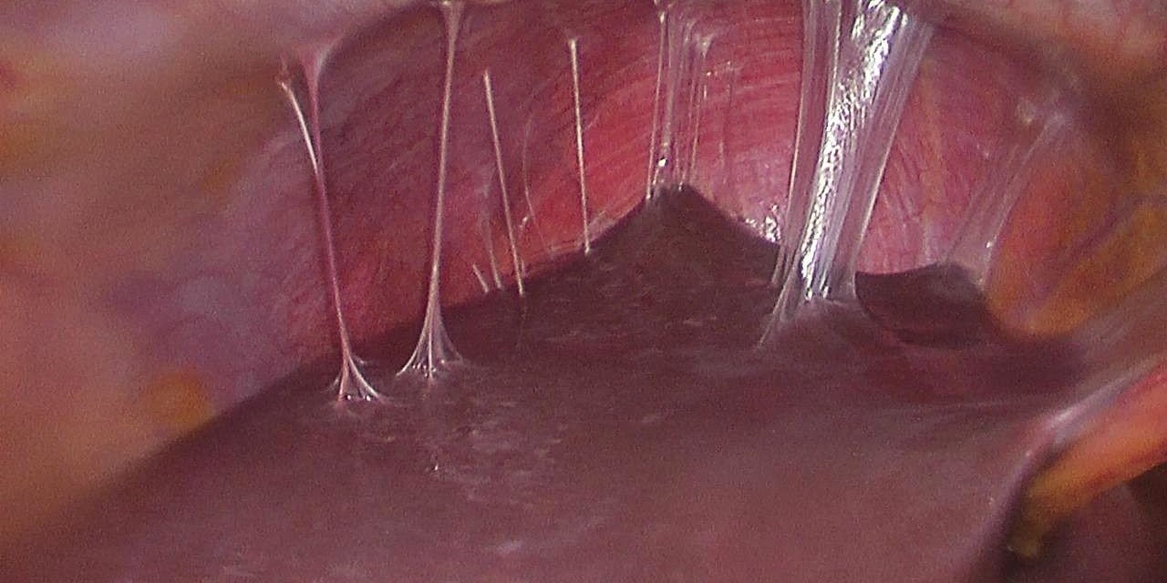 BUÜ’lü akademisyenin projesi “fıtık” oluşumunu engelleyecek