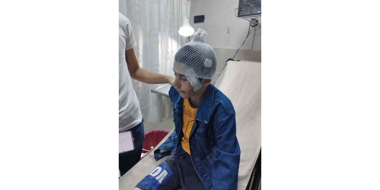 Salıncakta eğlenen çocuk bir anda kanlar içinde kaldı