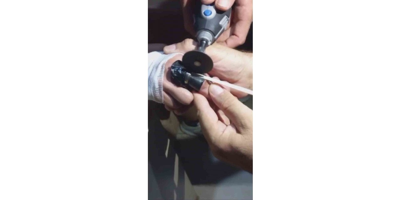 Yüzüğü parmağına sıkışan çocuğun yardımına itfaiye yetişti