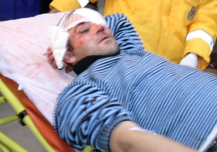 Arkadaşları tarafından darp edildi