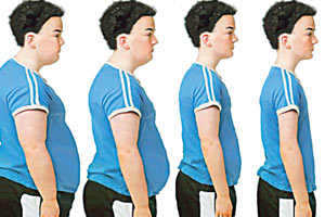 Obezite ameliyatlarında robotik devrim