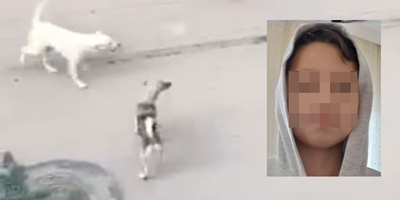 Başıboş köpeklerin saldırısına uğrayan 10 yaşındaki Utku yaralandı