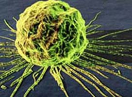 Kanserin başkenti Danimarka