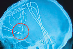 Tıp tarihinde bir ilk!