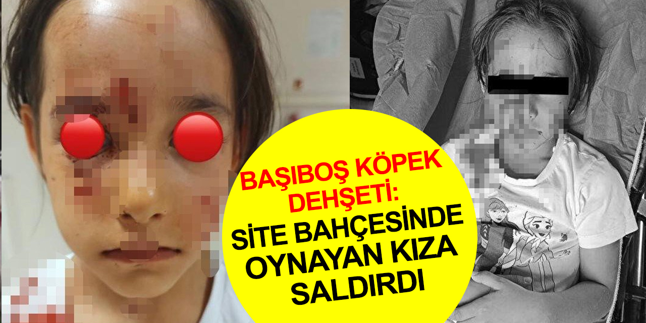 Başıboş köpek dehşeti: Site bahçesinde oynayan kıza saldırdı! İstanbul Valiliğinden açıklama geldi