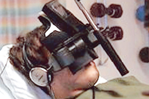 Yanık hastalarına oyunlu tedavi