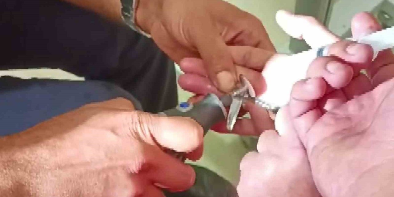 Yüzüğe sıkışan parmağı itfaiye ekipleri kurtardı