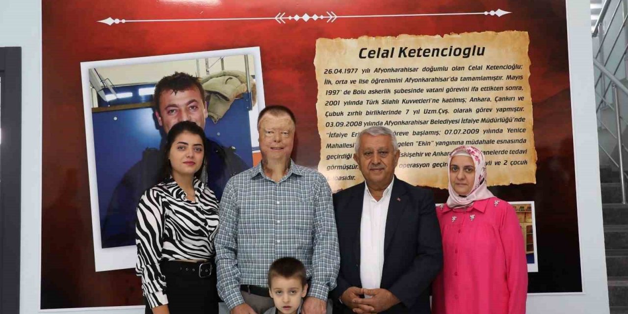 Başkan Zeybek’ten yaralanan itfaiye erine büyük vefa