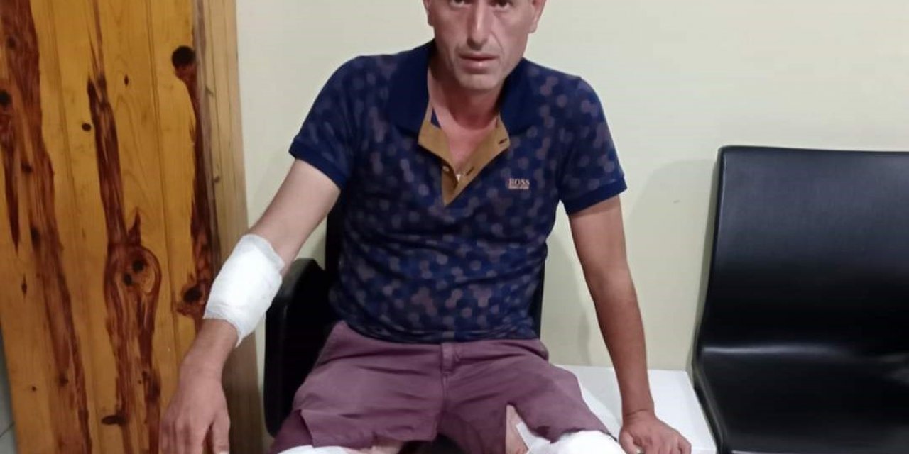 Sokak köpeklerinin saldırısına uğrayan Ersoy isyan etti