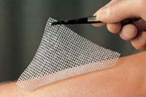 Yanıkları iyileştiren mucizevi sprey!