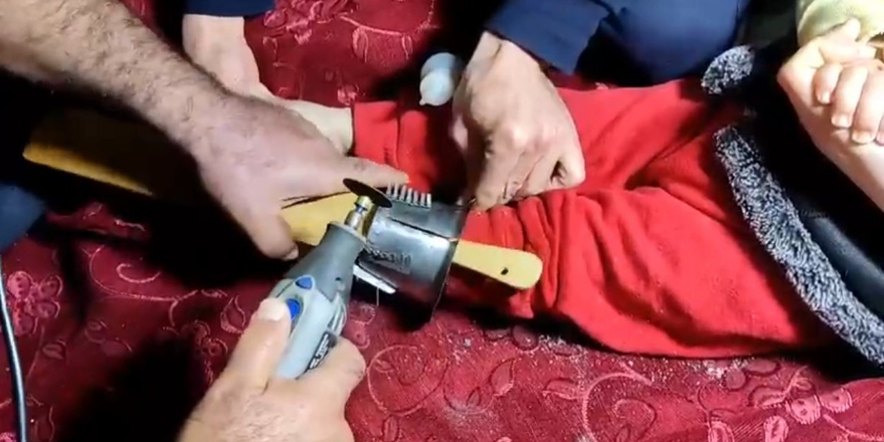 2 yaşındaki çocuk ayağını demir WC matiğe sıkıştırdı