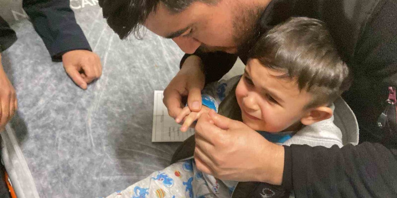 Kapak açacağına parmağını sıkıştırdı