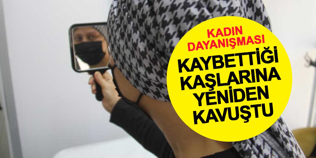 Kemoterapi ile kaybettiği kaşlarına yeniden kavuştu