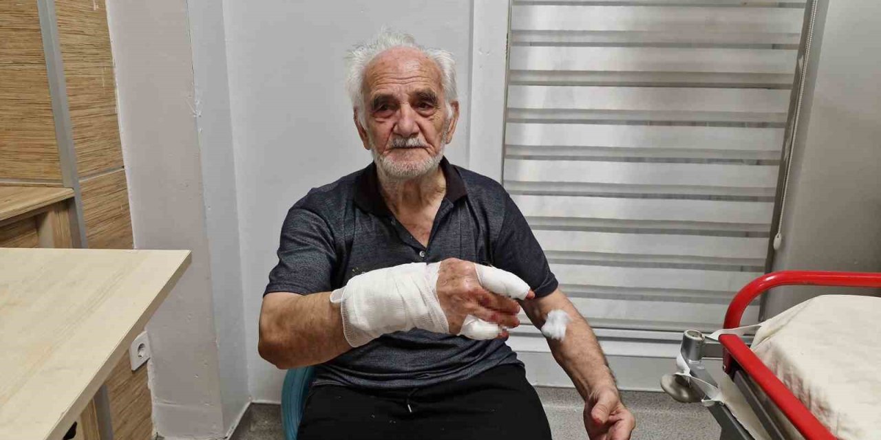 Zincirli çoban köpeği duvardan atlayıp yaşlı adamın elini parçaladı