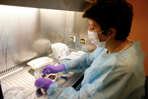 Göğüs kanserinin şifresi çözüldü