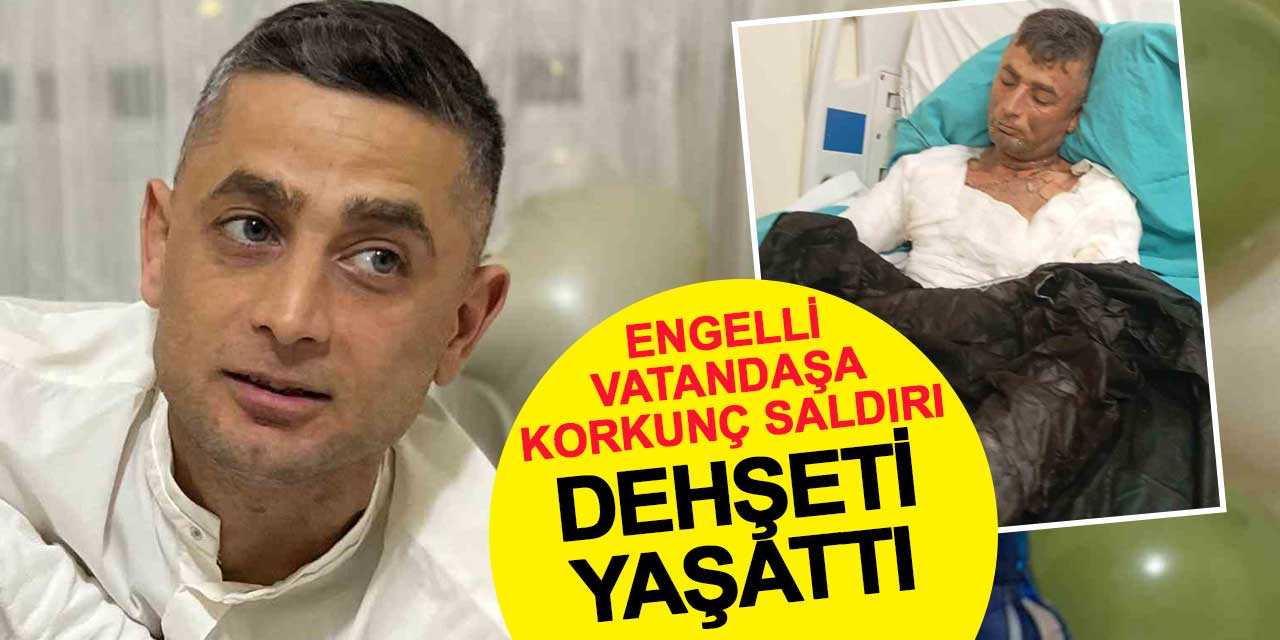 Benzin döküp ateşe verdi: Engelli vatandaşa dehşeti yaşattı
