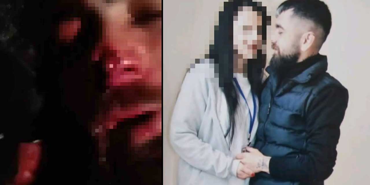 Eski sevgiliye işkence: Kulağını ve burnunu kopardılar