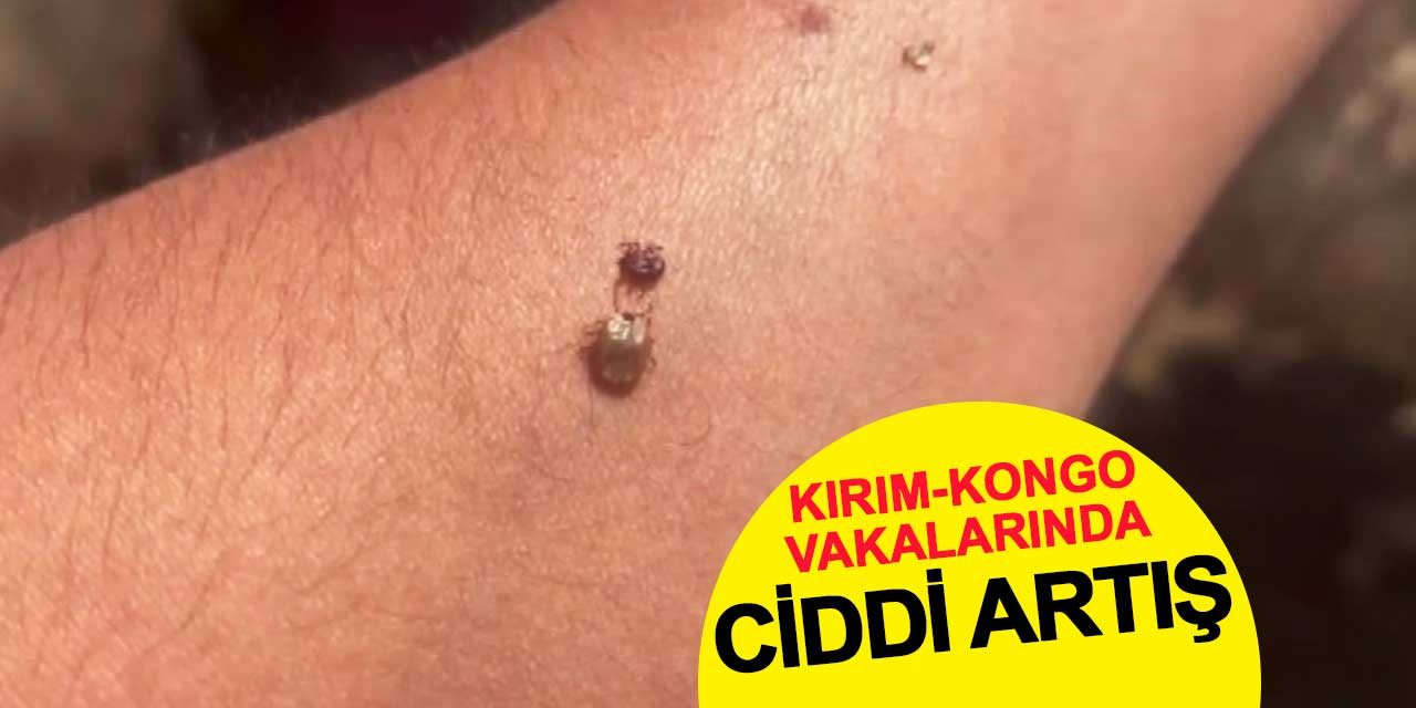 Kırım-Kongo Vakalarında Ciddi Artış