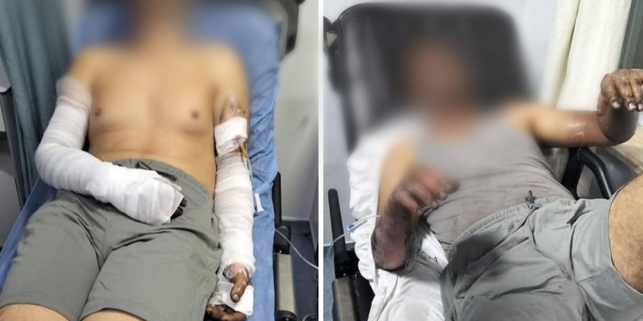 Sanayi sitesinde patlama: 2 kişi ölümden döndü