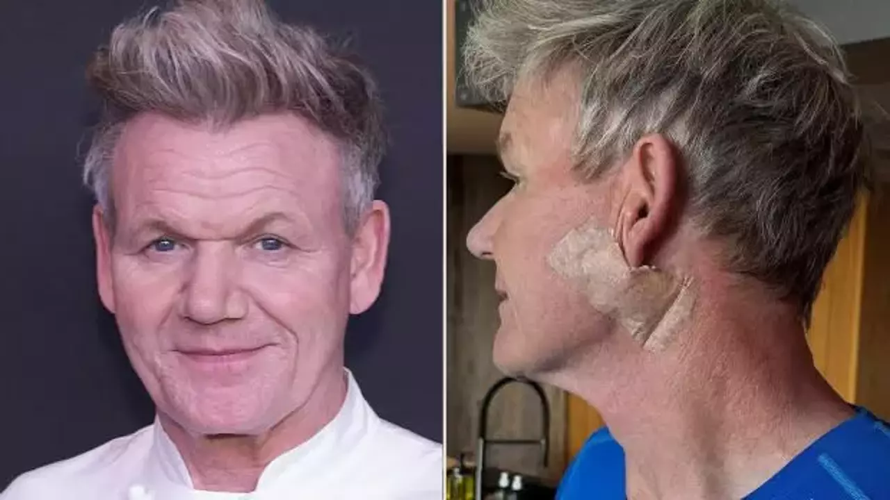 Gordon Ramsay Kansere Yakalandı