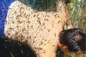 Sedef hastalığına balıkla tedavi