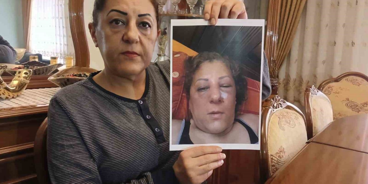 Kedi beslediği için burnunu kırdılar