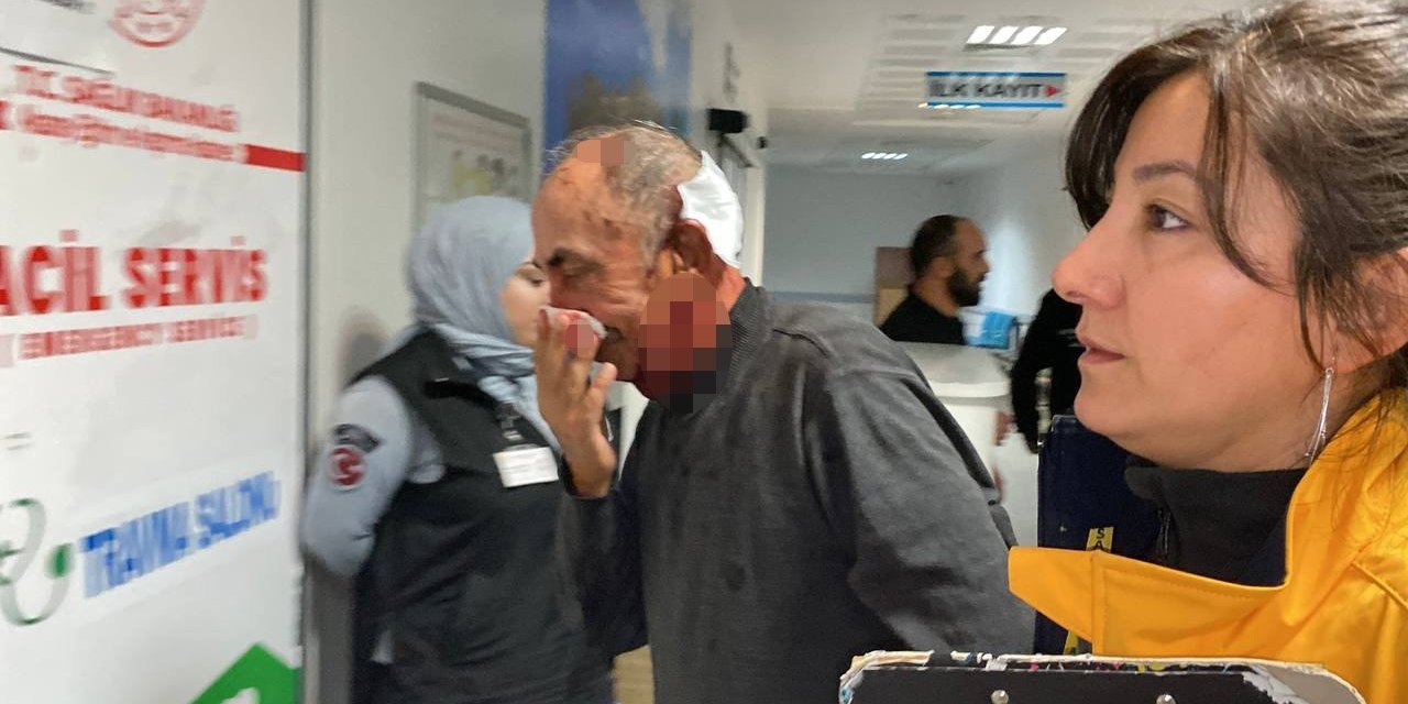 Aksaray'da Komşuluk Bitti Döner Bıçağı Devreye Girdi