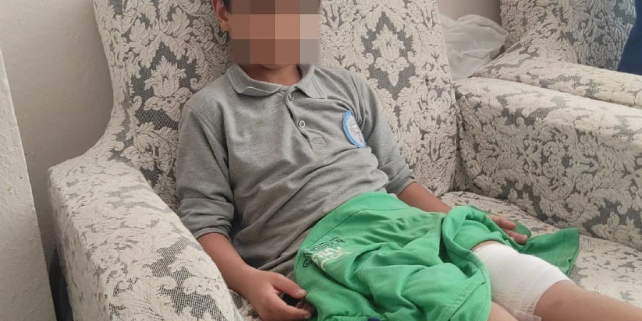 Orhangazi'de Okul Yolunda Dehşet: 8 Yaşındaki Çocuğa Sokak Köpeği Saldırdı!