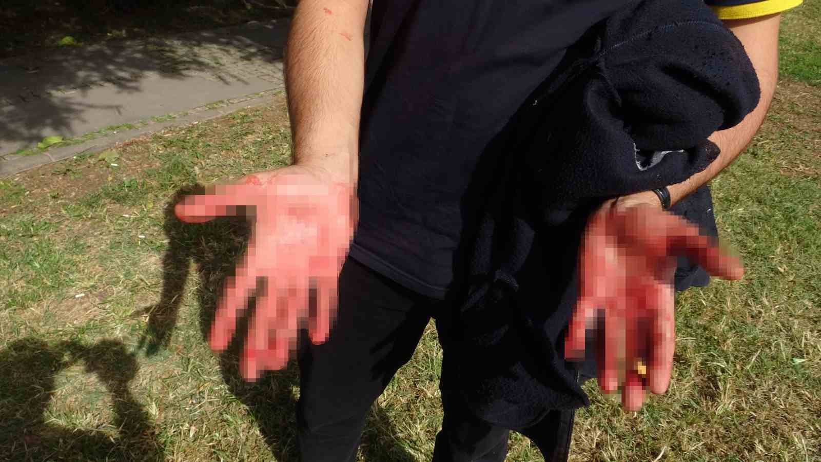 Kepez'de vatandaş korku içinde! Kimliği henüz belirsiz