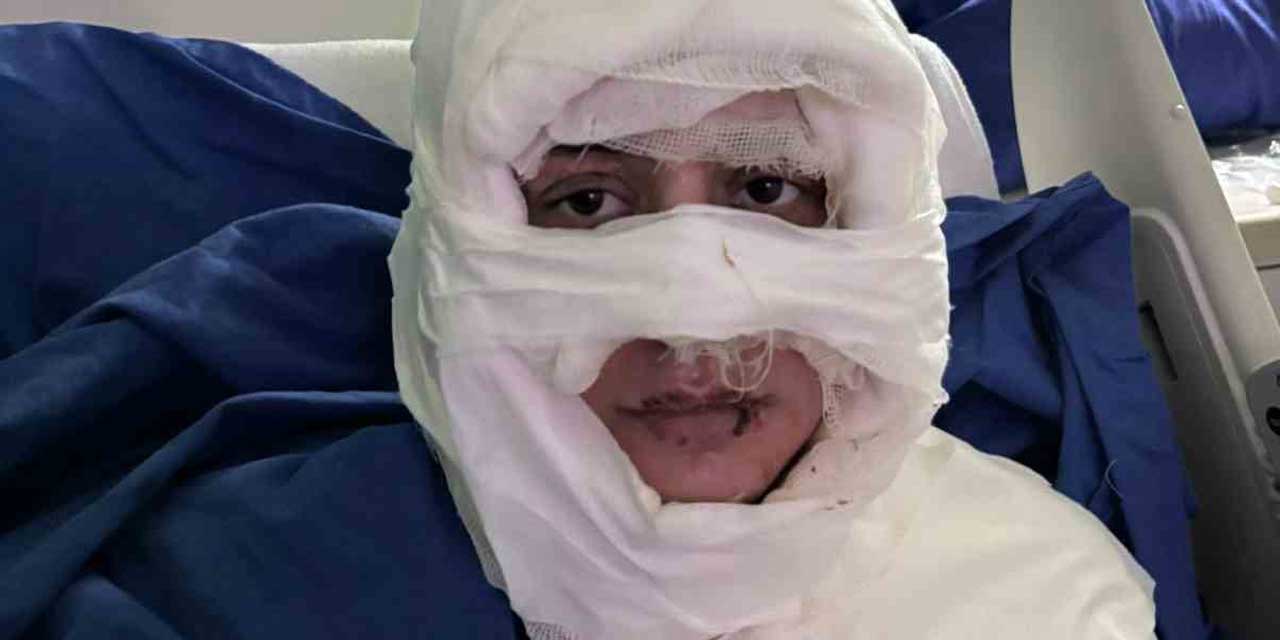 Dehşet Veren Saldırı: Kadın, Kadın Tarafından Yakıldı!