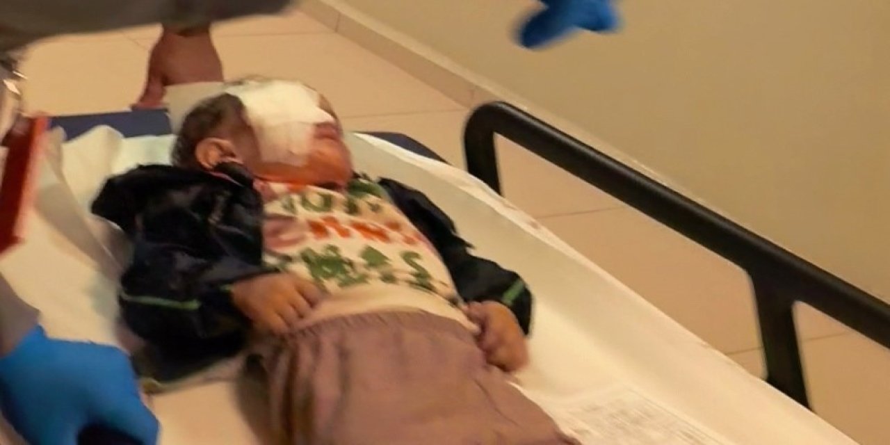 Oyuncak diye torpille oynayan 2 yaşındaki çocuk gözünden oldu