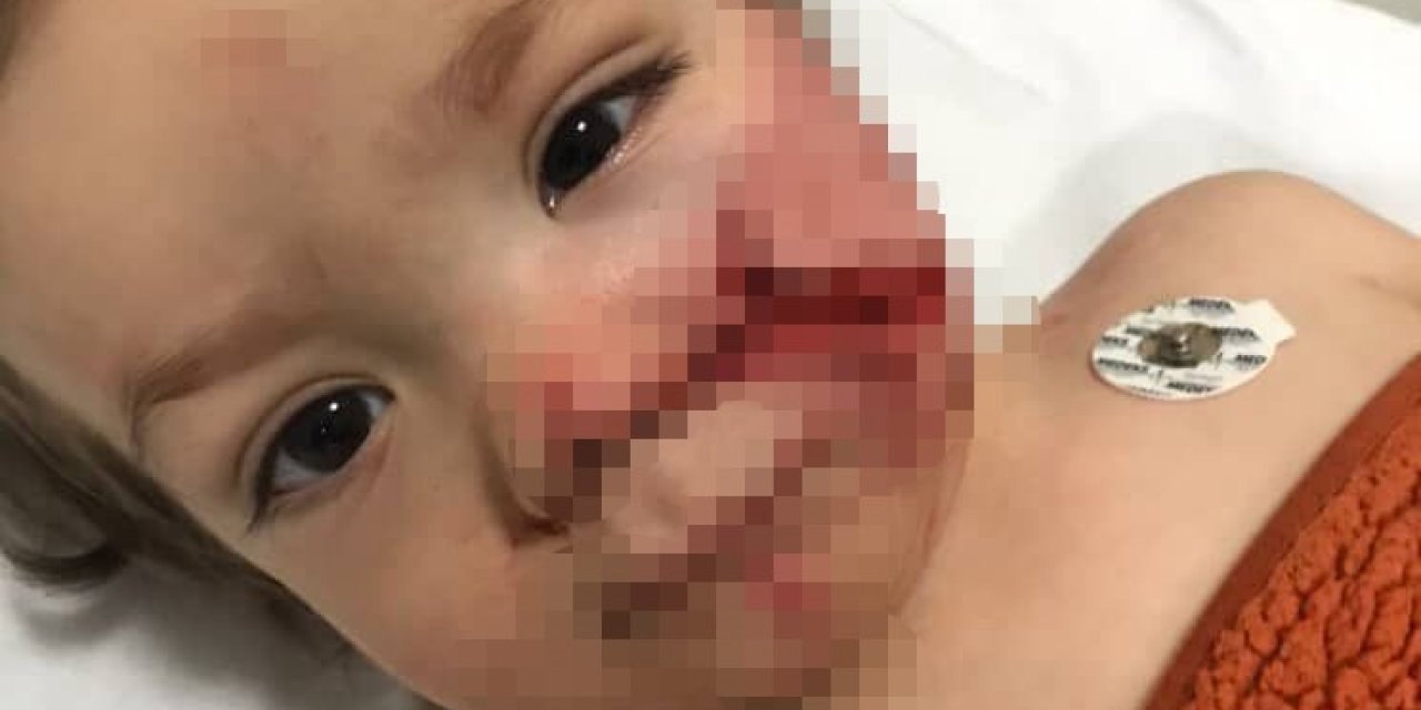 Ankara’da 2 çocuğu yaralayan pitbullun sahibi tutuklandı