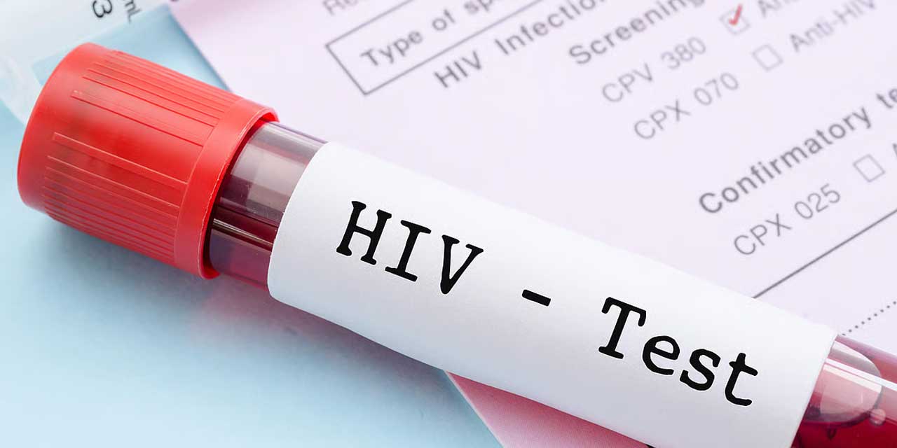 Türkiye'de HIV Vakaları Genç Yaşlarda Hızla Artıyor: Kritik Uyarı