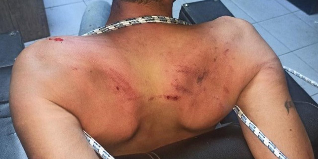 Hamam böceği yedirilen Vedat Kurt’a işkence davasında karar çıktı
