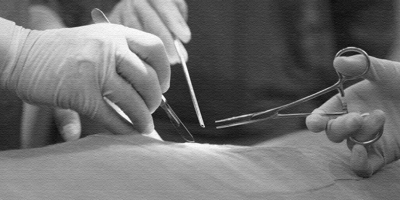 Yıllardır Sinsice Büyümüş: Karın Boşluğunu Dolduran Dev Kitle Çıkarıldı